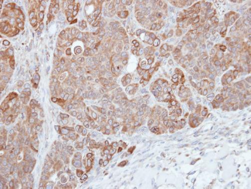 Anti-HPS3 antibody [C3], C-term used in IHC (Formalin-fixed paraffin-embedded sections). GTX107745