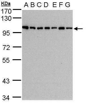 Anti-HPS3 antibody [C3], C-term used in Western blot. GTX107745