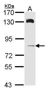 Anti-HPS6 antibody [C1], Internal used in Western blot. GTX107720