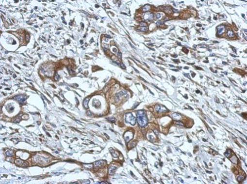 Anti-HPS6 antibody [N2C1], Internal used in IHC (Formalin-fixed paraffin-embedded sections). GTX116845