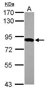 Anti-HPS6 antibody [N2C1], Internal used in Western blot. GTX116845