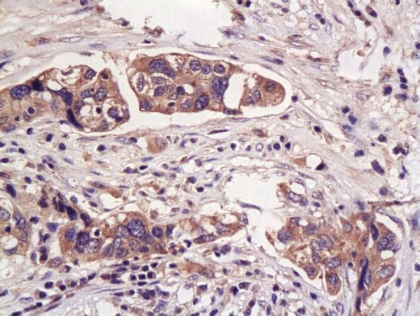 Anti-Hpt antibody used in IHC (Formalin-fixed paraffin-embedded sections). GTX51524