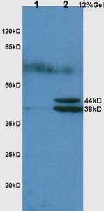 Anti-Hpt antibody used in Western blot. GTX51524