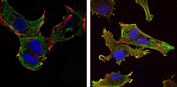 Anti-KLHL13 antibody [8D1] used in ICC/IF. GTX82815