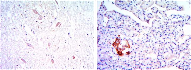 Anti-KLHL13 antibody [8D1] used in IHC (Formalin-fixed paraffin-embedded sections). GTX82815