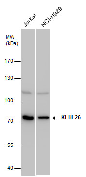 Anti-KLHL26 antibody used in Western blot. GTX120879