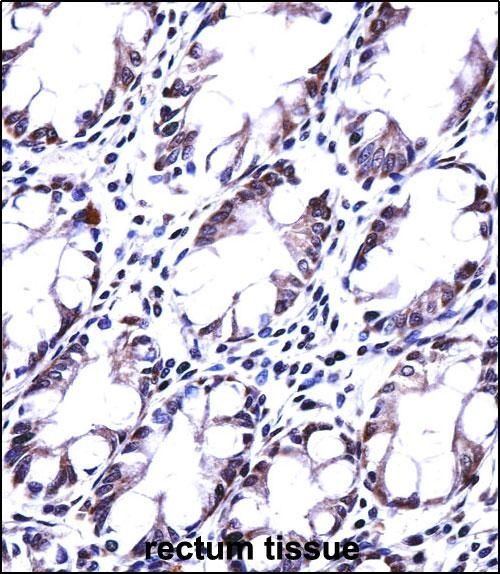 Anti-HRASLS5 antibody used in Immunohistochemistry. GTX53561