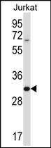 Anti-HRASLS5 antibody used in Western blot. GTX53561