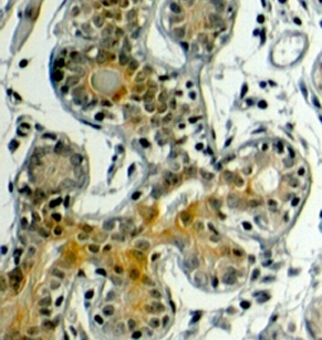 Anti-Klotho antibody, Internal used in IHC (Formalin-fixed paraffin-embedded sections). GTX89443