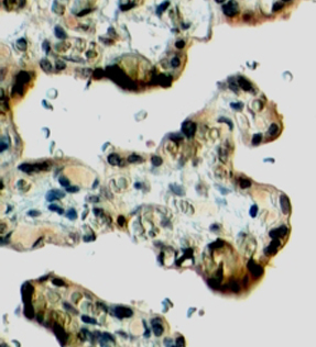 Anti-Klotho antibody, Internal used in IHC (Formalin-fixed paraffin-embedded sections). GTX89443