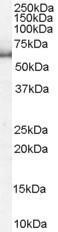 Anti-KPNA1 / Importin alpha 5 antibody, N-term used in Western blot. GTX26035