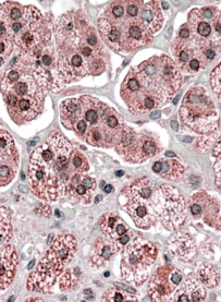 Anti-KPNA6 antibody, Internal used in IHC (Formalin-fixed paraffin-embedded sections). GTX88712