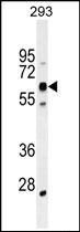Anti-KRBA2 antibody used in Western blot. GTX53621