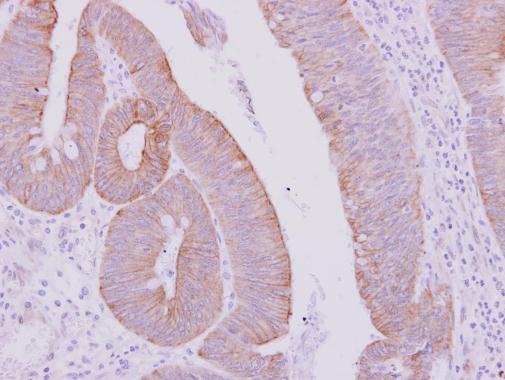 Anti-KRT71 antibody [N3C3] used in IHC (Formalin-fixed paraffin-embedded sections). GTX107343