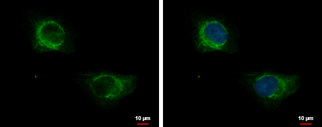 Anti-KRT71 antibody [N3C3] used in ICC/IF. GTX107343