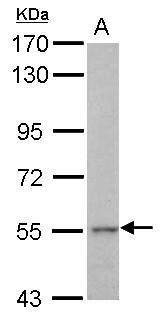Anti-KRT71 antibody [N3C3] used in Western blot. GTX107343