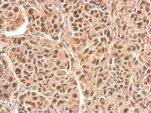 Anti-HRSP12 antibody used in IHC (Formalin-fixed paraffin-embedded sections). GTX119107