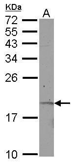 Anti-KRTAP11-1 antibody [N1C3] used in Western blot. GTX122177
