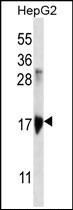 Anti-KRTAP1-3 antibody used in Western blot. GTX53630
