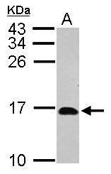 Anti-HRSP12 antibody used in Western blot. GTX119107