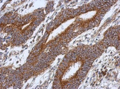 Anti-HS3ST2 antibody used in IHC (Formalin-fixed paraffin-embedded sections). GTX118041