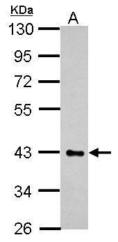 Anti-HS3ST2 antibody used in Western blot. GTX118041