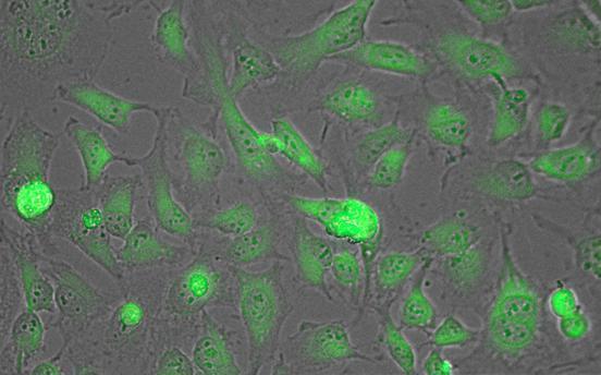 Anti-Lactate Dehydrogenase antibody used in ICC/IF. GTX22101