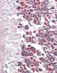 Anti-Laforin (isoform a) antibody, Internal used in IHC (Formalin-fixed paraffin-embedded sections). GTX88479