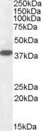 Anti-Laforin (isoform a) antibody, Internal used in Western blot. GTX88479