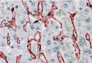 Anti-LARP2 antibody, Internal used in IHC (Formalin-fixed paraffin-embedded sections). GTX89042