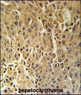 Anti-HSD17B13 antibody used in Immunohistochemistry. GTX53602