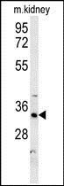 Anti-HSD17B13 antibody used in Western blot. GTX53602