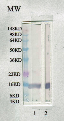 Anti-Leptin antibody used in Western blot. GTX17629