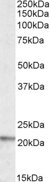 Anti-LIGHT / CD258 antibody, Internal used in Western blot. GTX88321