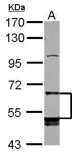 Anti-LILRB5 antibody [N2C1], Internal used in Western blot. GTX104193
