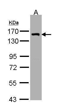 Anti-LIMCH1 antibody [C2C3], C-term used in Western blot. GTX108649