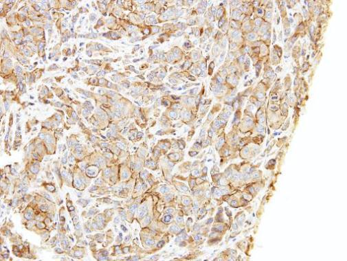 Anti-LIMCH1 antibody [C2C3], C-term used in IHC (Formalin-fixed paraffin-embedded sections). GTX108649