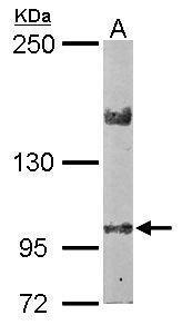 Anti-LIMCH1 antibody [C2C3], C-term used in Western blot. GTX108649