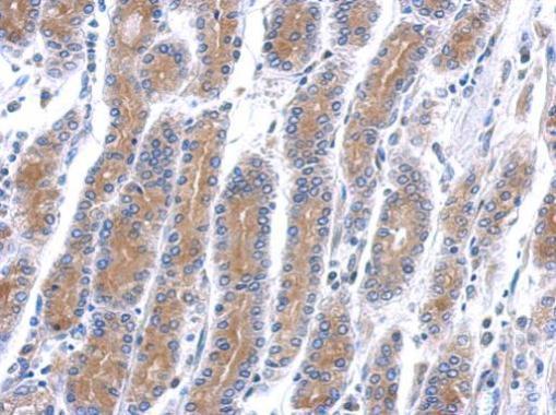 Anti-HSD17B6 antibody [N1C3] used in IHC (Formalin-fixed paraffin-embedded sections). GTX109009