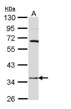 Anti-HSD17B6 antibody [N1C3] used in Western blot. GTX109009