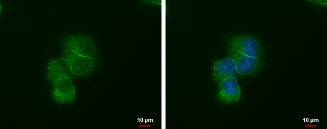 Anti-LIN7A antibody [GT377] used in ICC/IF. GTX631106