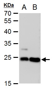 Anti-LIN7A antibody [GT377] used in Western blot. GTX631106