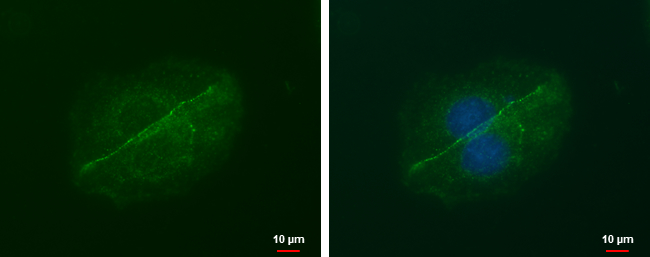 Anti-LIN7A antibody [GT879] used in ICC/IF. GTX631107