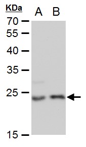 Anti-LIN7A antibody [GT879] used in Western blot. GTX631107