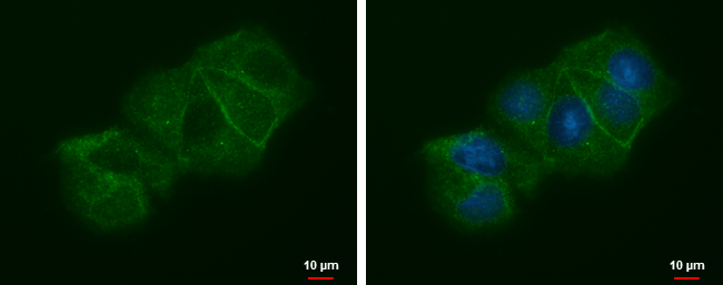 Anti-LIN7A antibody [N1C3] used in ICC/IF. GTX117114