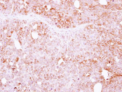 Anti-LIN7A antibody [N1C3] used in IHC (Formalin-fixed paraffin-embedded sections). GTX117114