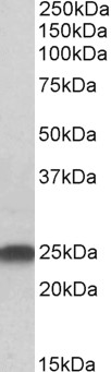 Anti-LIN7B antibody, N-term used in Western blot. GTX25967