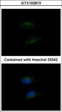 Anti-HSD3B2 antibody [N3C3] used in ICC/IF. GTX102813