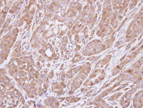 Anti-HSD3B2 antibody [N3C3] used in IHC (Formalin-fixed paraffin-embedded sections). GTX102813