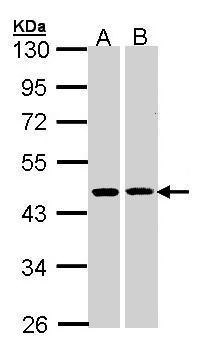 Anti-HSD3B2 antibody [N3C3] used in Western blot. GTX102813